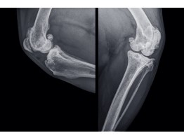 Osteoporóza psov – štúdia